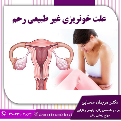 علت خونریزی غیر طبیعی رحم