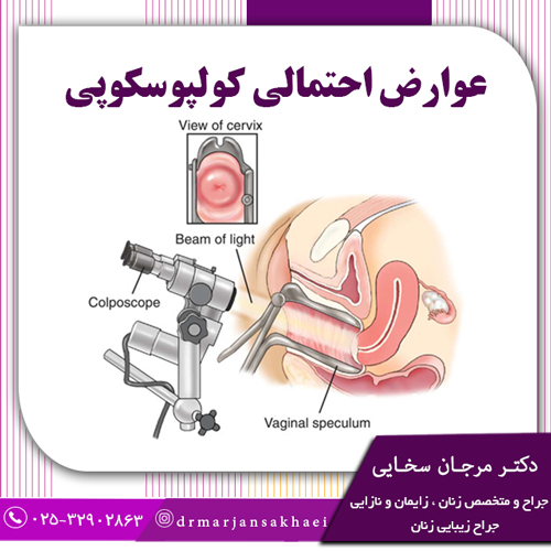 عوارض احتمالی کولپوسکوپی