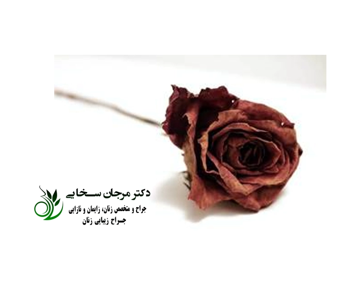 درمان خشکی واژن با دستگاه RF